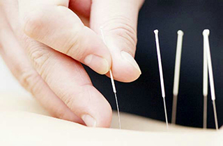 تلاش چین برای صدور طب سنتی خود + فیلم