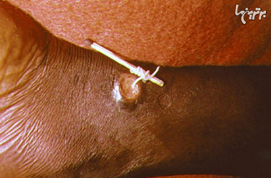 خطرناکترین حشرات دنیا که سلامتی شما را تهدید می کنند!+ تصاویر