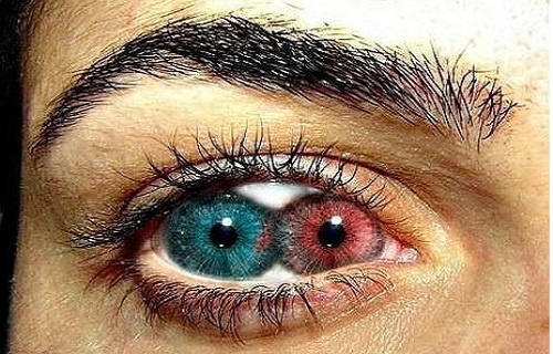 چشم دو مردمکی؛+ تصاویر چشم دو مردمکی؛+ تصاویر