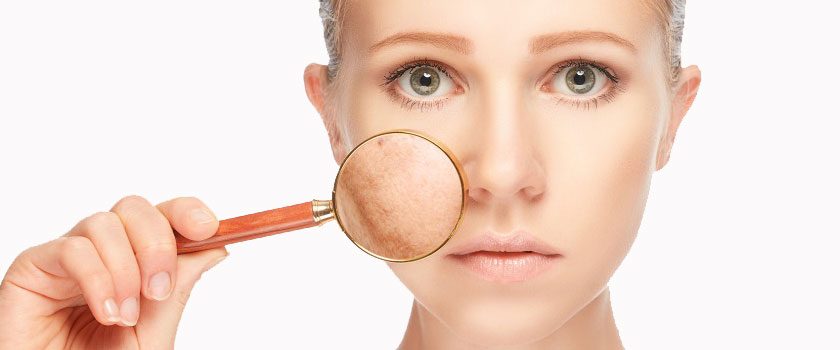 برای رفع لکه های قهوه ای صورت چه باید کرد؟