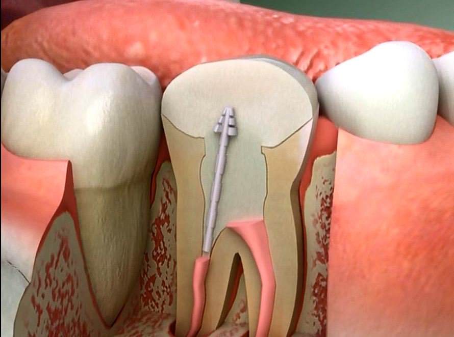 دستیابی شرکت&zwnj;های دانش بنیان به تجهیزات جدید دندانپزشکی