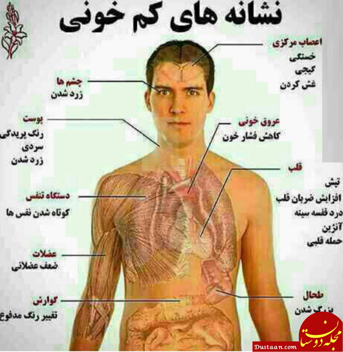 علایم کم خونی چیست؟+درمان آن با کمک طب سنتی
