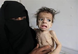 هشدار سازمان ملل درباره خطر قحطی برای دو میلیون مادر یمنی