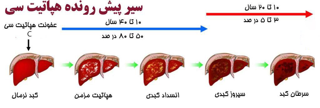 هپاتیت،بیماری به رنگ پاییز