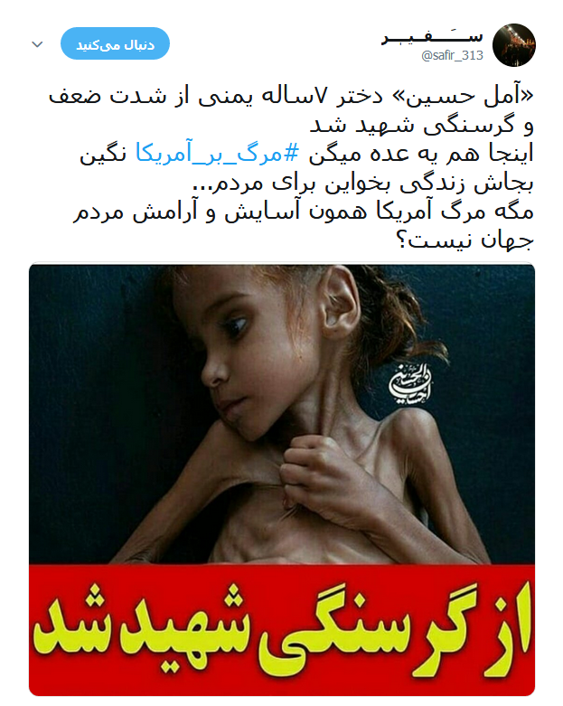 امل حسین دختر خردسال یمنی که دیگر لبخند نمی زند +تصاویر