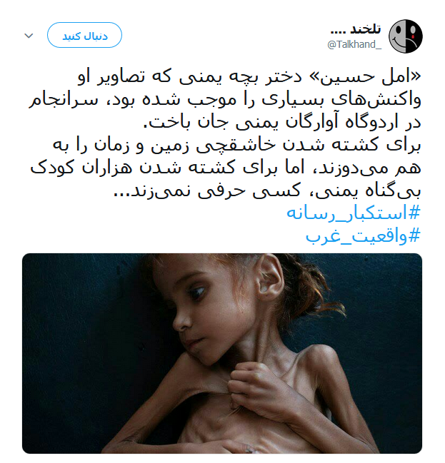 امل حسین دختر خردسال یمنی که دیگر لبخند نمی زند +تصاویر