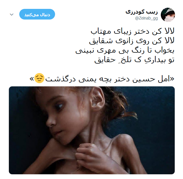 امل حسین دختر خردسال یمنی که دیگر لبخند نمی زند +تصاویر
