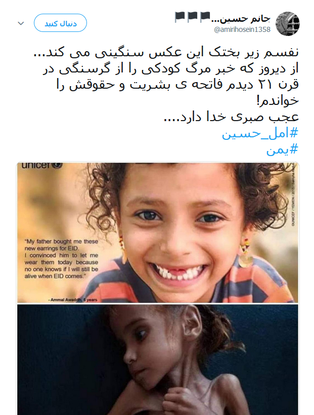 امل حسین دختر خردسال یمنی که دیگر لبخند نمی زند +تصاویر
