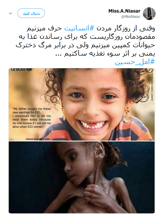 امل حسین دختر خردسال یمنی که دیگر لبخند نمی زند +تصاویر