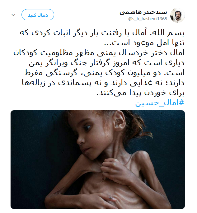 امل حسین دختر خردسال یمنی که دیگر لبخند نمی زند +تصاویر