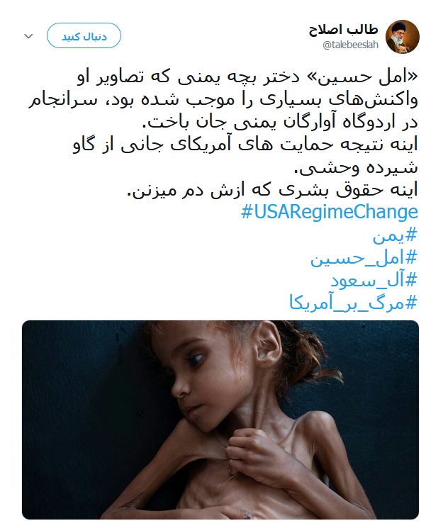 امل حسین دختر خردسال یمنی که دیگر لبخند نمی زند +تصاویر