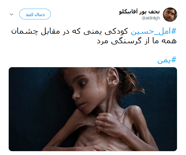 امل حسین دختر خردسال یمنی که دیگر لبخند نمی زند +تصاویر