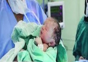 کاهش شاخص سزارین در استان قزوین
