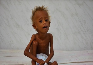 سازمان ملل: 14 میلیون یمنی در خطر گرسنگی و قحطی