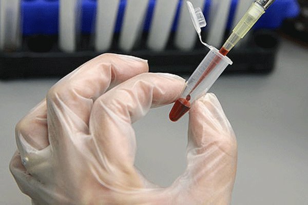 کسب رتبه برتر کشوری در افزایش تعداد نمونه خون بند ناف