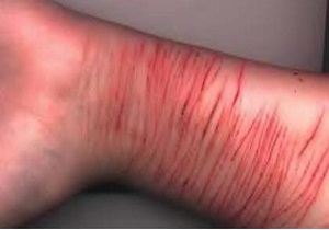 ماجرای خودزنی دانش آموز اهوازی چه بود؟