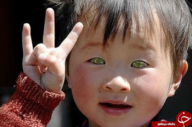 انتشار تصاویری از زیباترین کودکان چشم رنگی در فضای مجازی