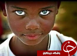 انتشار تصاویری از زیباترین کودکان چشم رنگی در فضای مجازی
