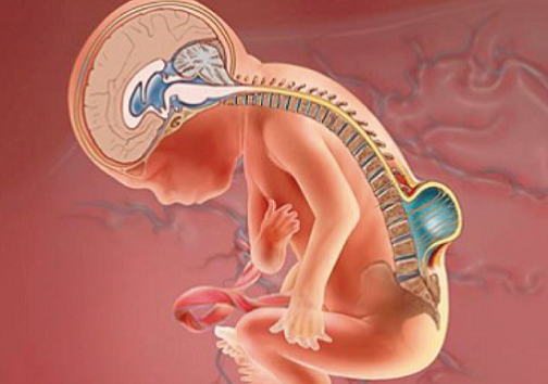 ناهنجاری مادرزادی، یکی از اصلی ترین عوامل مرگ و میر در نوزادان ایرانی