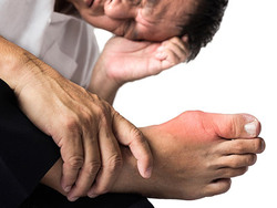 چرا نقرس می&zwnj;گیریم؟+ اینفوگرافی