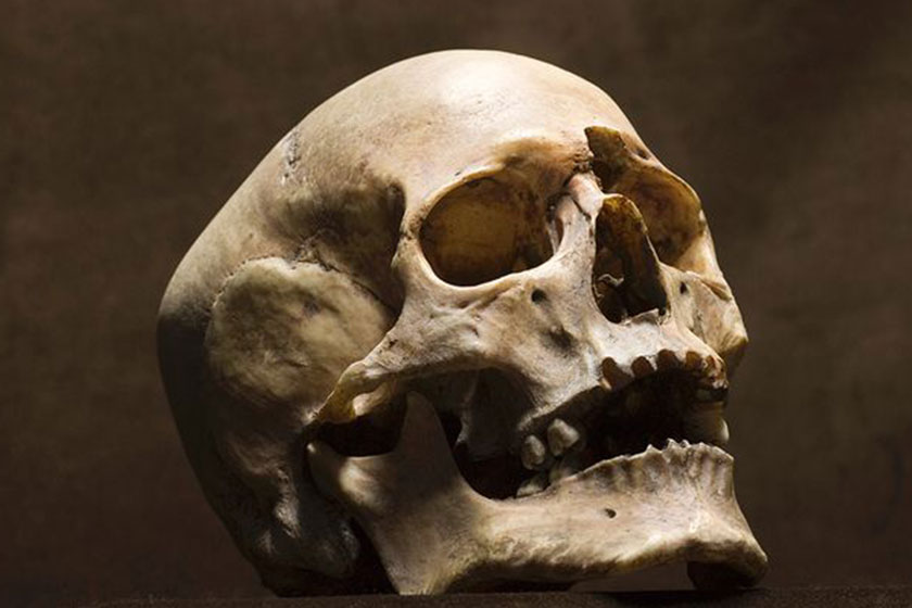 ماجرای بیرون&zwnj;زدن کله اسکلت از ساختمان های تازه ساز در ایران!