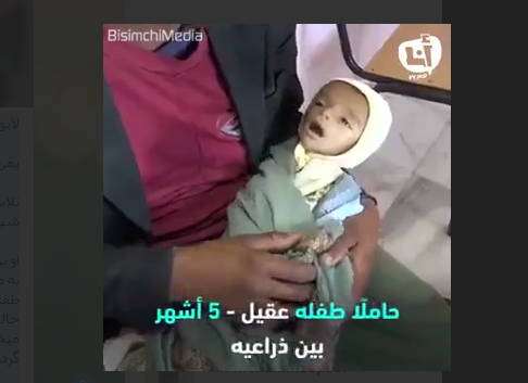 لحظاتی دردناک از تلاش پدر یمنی برای نجات جان کودک شیرخواره‌اش +فیلم