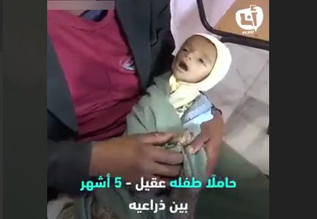 تلاش پدر یمنی برای نجات کودک شیرخواره 5 ماهه&zwnj;اش+ فیلم
