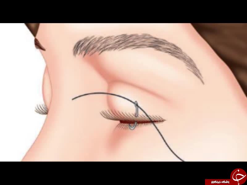 نکاتی که باید پیش ازکاشت مژه رعایت شود + خطرات کاشت مژه/ پیشنهادی برای کم پشتی مژه&zwnj;ها