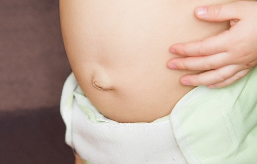 تق ناف چیست؟/اگر شکم نوزاد بادکرد گوش به زنگ باشید