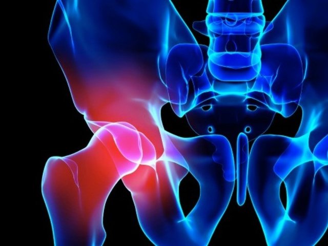 ورزشپ&zwnj;های مناسب برای درمان آرتروز لگن+ تصاویر