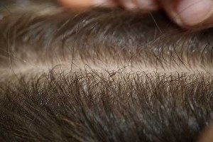فعالیت ۵۵۰ مراقب سلامت در مدارس گیلان