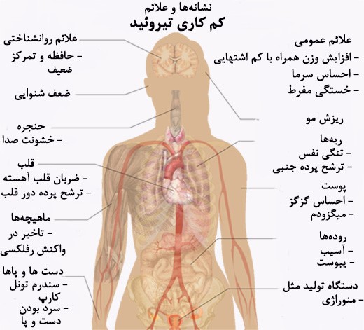 آموزش خواندن آزمایش تیروئید/ چطور بفهمیم کم کاری یا پرکاری تیروئید داریم؟