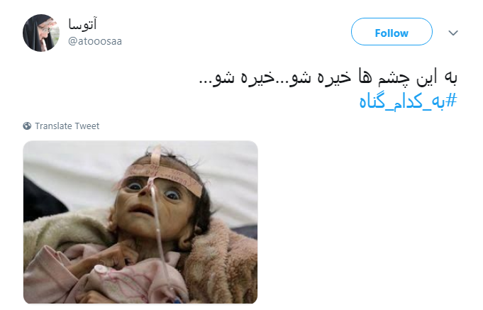 کودکان یمنی به #به_کدام_گناه جان می&zwnj;دهند؟