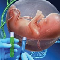 غربالگری ۱۱۰ هزار ازدواج در سال ۹۶/ غربالگری ژنتیک از سازمان بهزیستی گرفته شد
