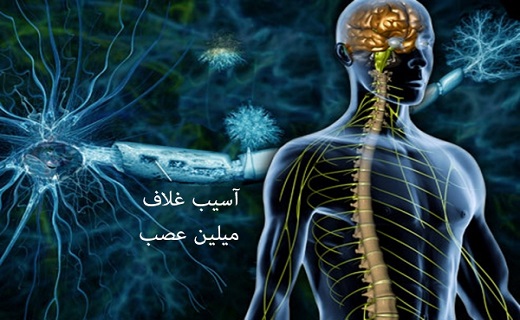 سلول درمانی، امیدی تازه برای بیماران ام اس / قطع مصرف خودسرانه دارو&zwnj;ها، ممنوع