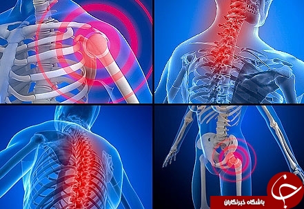 همه آنچه که درباره یک بیماری ناشناخته به نام فیبرومیالژی باید بدانید+ معرفی انواع دردها و راهکارهای درمانی همه آنچه که درباره یک بیماری ناشناخته به نام فیبرومیالژی باید بدانید+ معرفی انواع دردها و راهکارهای درمانی