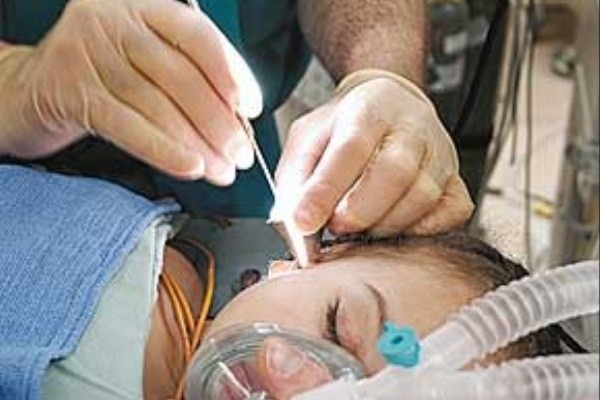 تولد سالانه پنج هزار نوزاد کم شنوا/ پوشش ۸۰ درصدی غربالگری شنوایی کودکان