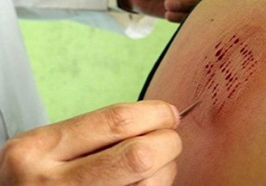 چه افرادی نمی&zwnj;توانند حجامت کنند؟ + فیلم