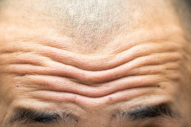 (دانستنی) رفع چین و چروک صورت با روشی ارزان/ رفع شوره سر با روغنی دم دستی/ گیاهی عالی برای درمان نرمی استخوان
