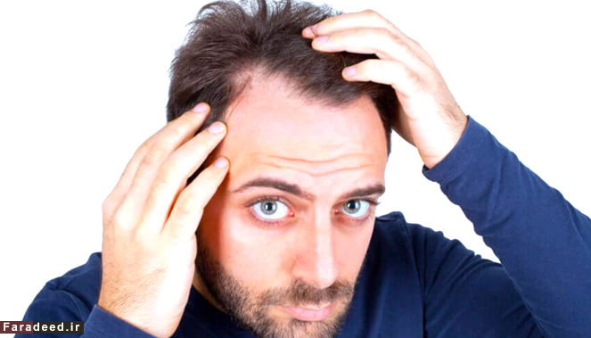 چطور از شر مو‌های خشک خلاص شویم؟