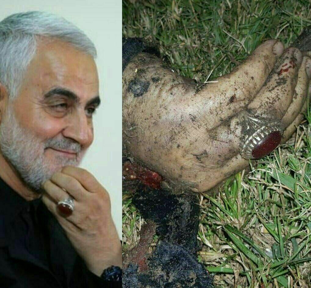 انشار اولین تصاویر از شهید سردار سلیمانی پس از حمله تروریستی بامداد