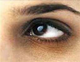 تیرگی دور چشم های خود را با این روش نابود کنید
