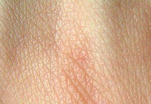 تاپ شنبه. کدام مواد غذایی چه اندام هایی را از کار می اندازند؟