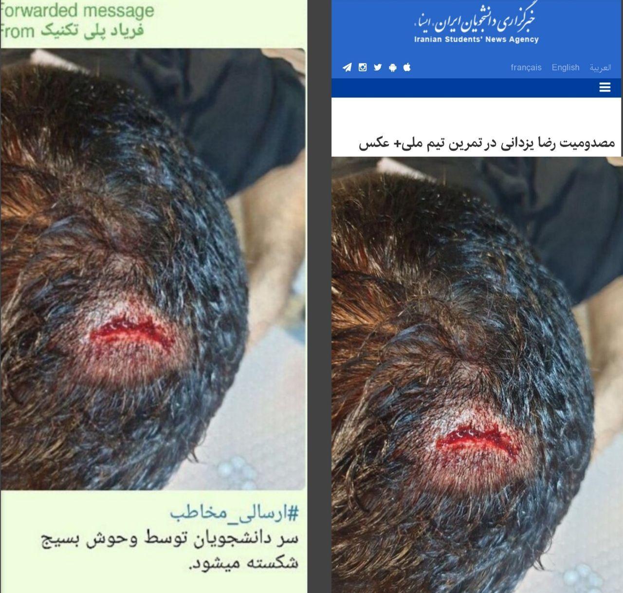 پروژه خشونت سازی اینبار با تصاویر مسدومیت کشتی گیر ایرانی