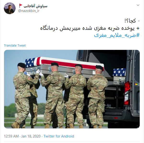 #ضربه_ملایم_مغزی #ضربه_ملایم_مغزی