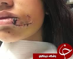 اقدام خطرناک دختر جوان در گرفتن عکس یادگاری با سگ!