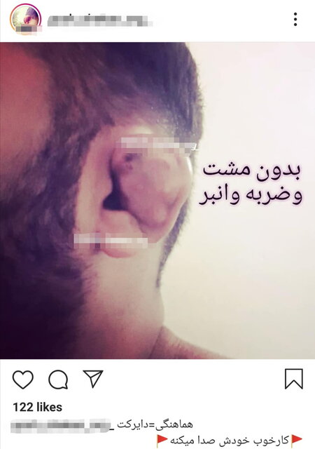 چند می&zwnj;گیری گوش بشکونی؟