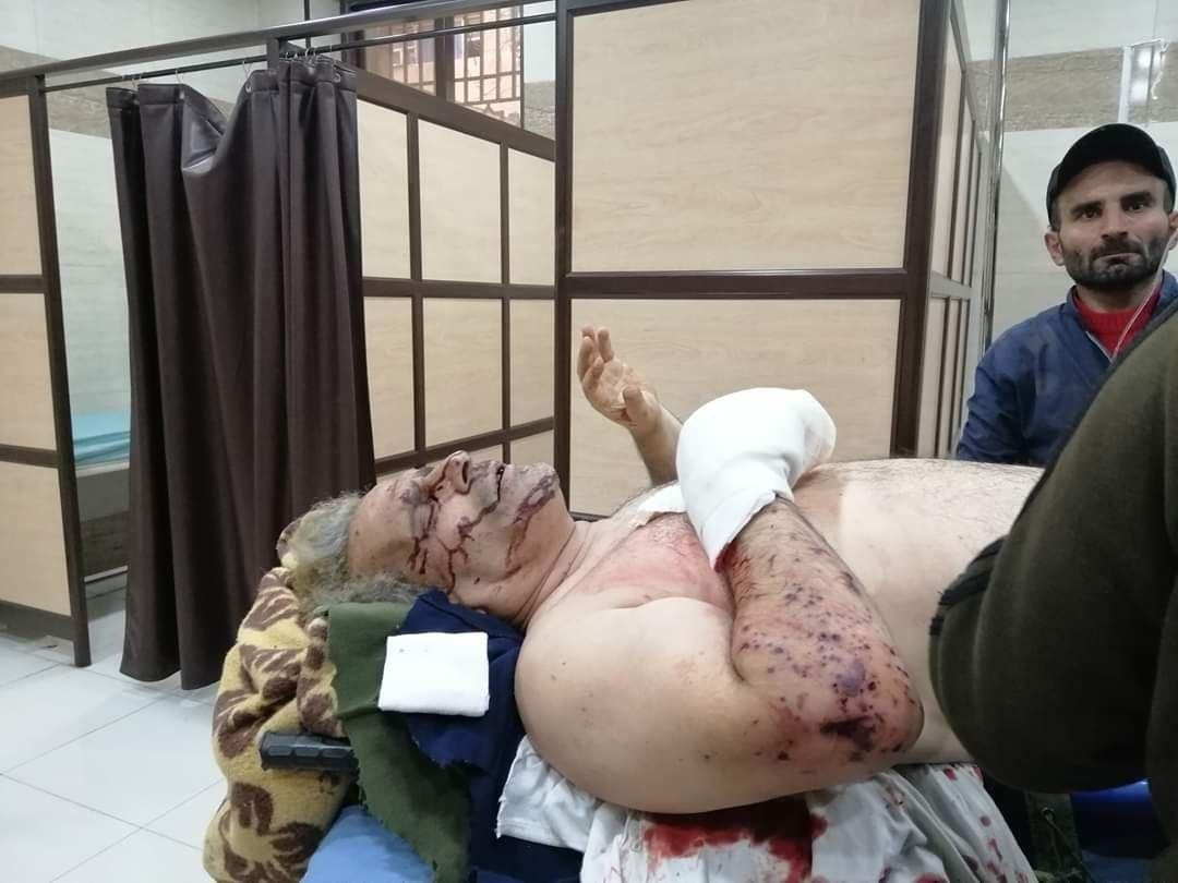تروریست&zwnj;ها خبرنگاران العالم و الکوثر را هدف حمله قرار دادند