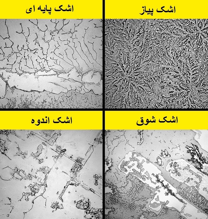 ۱۰ حقیقت جالب درباره اشک&zwnj;های انسان که نمی&zwnj;دانستید