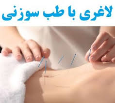 آیا طب سوزنی تاثیری در کاهش وزن دارد؟